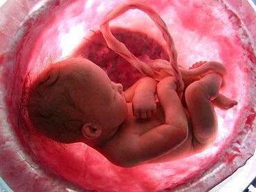 Sonhar com aborto